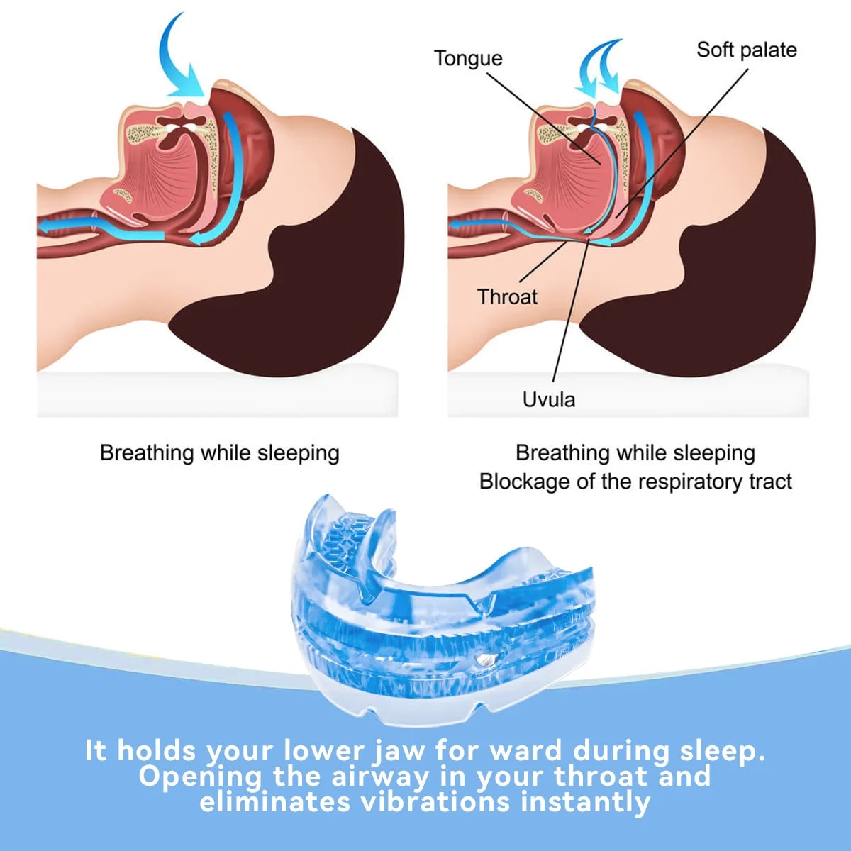 Anti Snoring Mouthpiece Mouth Guard Adjustable Metal Screwdriver Storage Case - Image 3