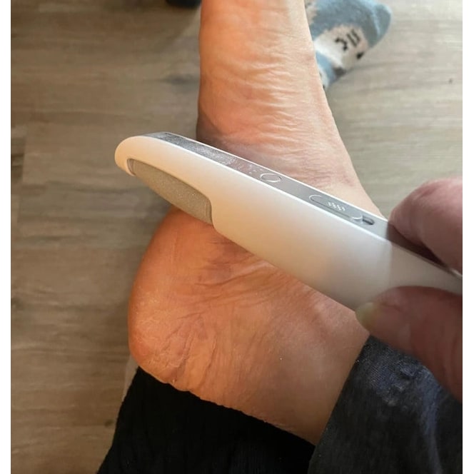 Electric Foot File and Callus Remover with Rechargeable Rotating Roller and Adjustable Speeds - Image 16