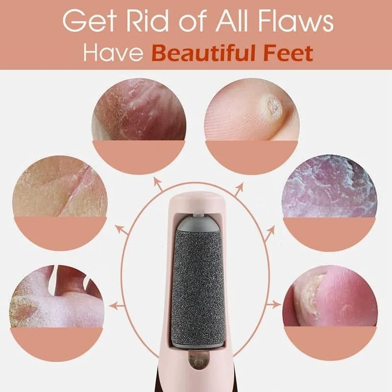 Electric Foot File and Callus Remover with Rechargeable Rotating Roller and Adjustable Speeds - Image 17