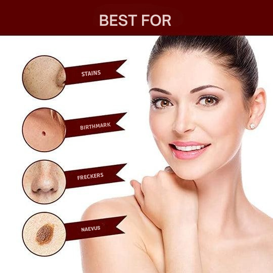 Natural Skin Tag Remover At-Home Wart Pen Brush Tip Liquid - Image 7