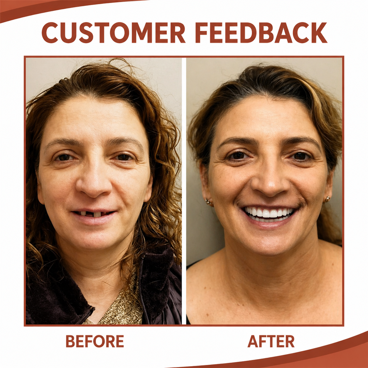 Snap on Veneers Fake Teeth Removable Cosmetic Smile Whitening Kit Instant - Image 3