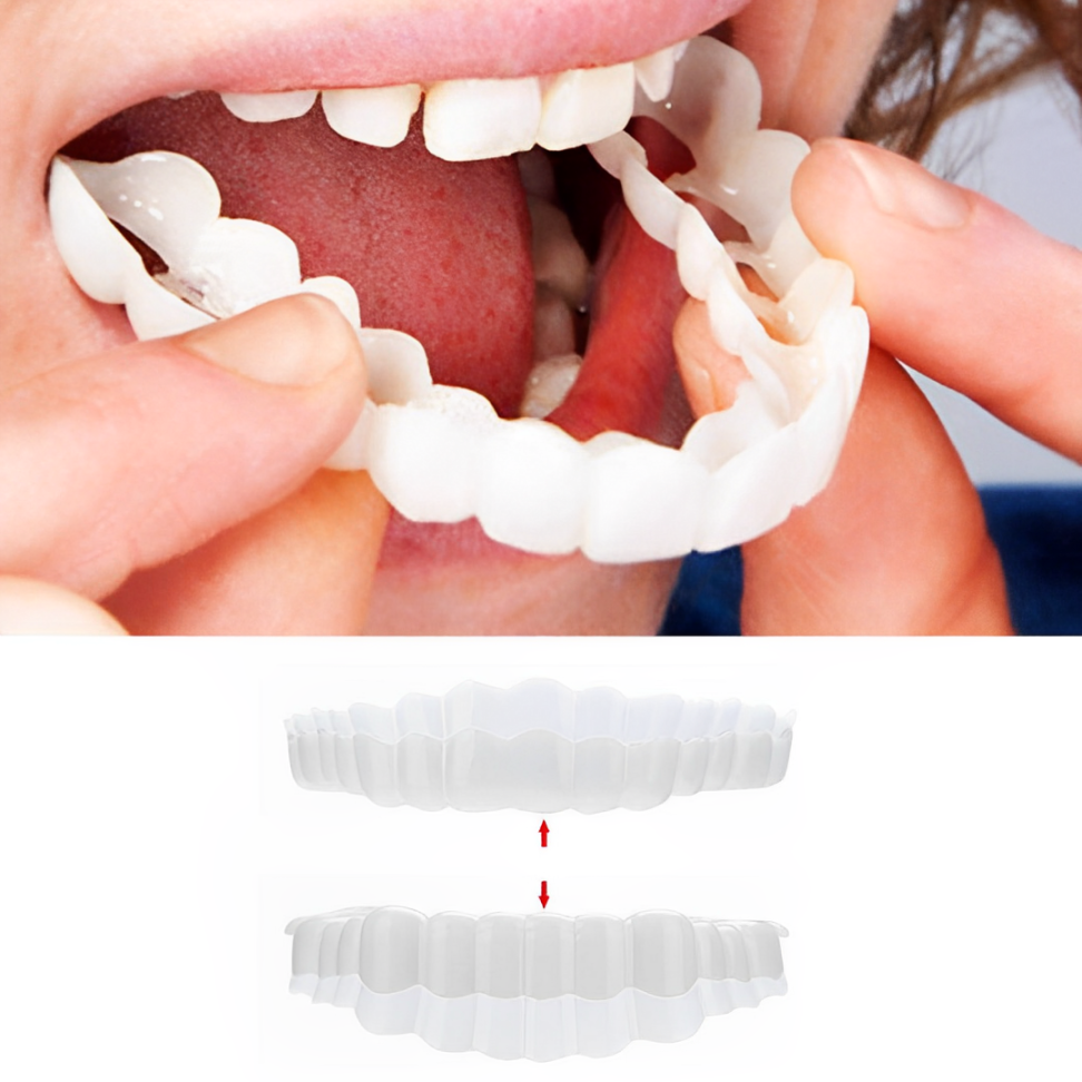 Snap on Veneers Temporary Removable Moldable Teeth Upper Lower - Image 1