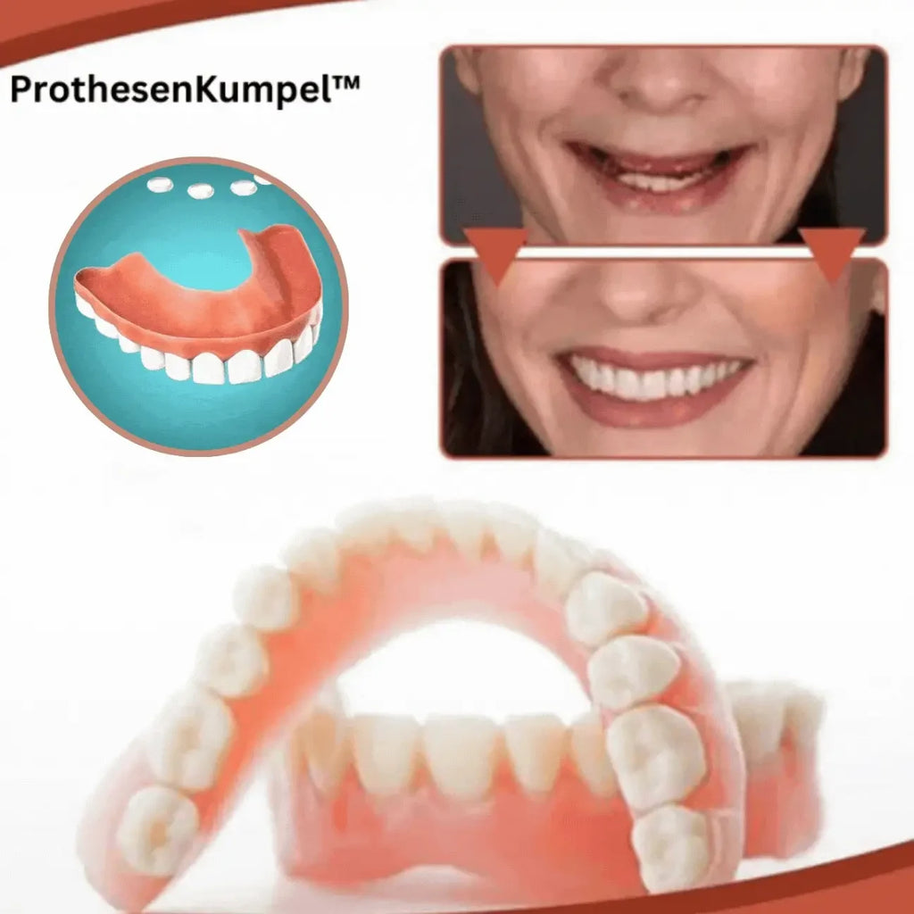 Snap on Veneers with Custom Fit Moldable Beads and Artificial Gums - Image 4