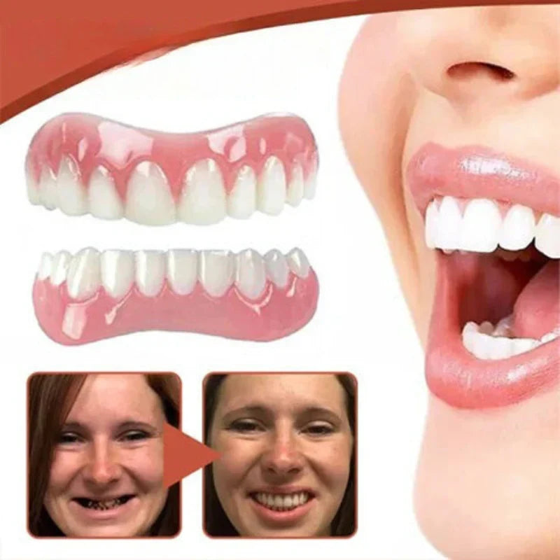 Snap on Veneers with Moldable Thermal Beads for Custom Fit Cosmetic Teeth - Image 4