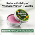 Swelling Cream with Diclofenac Sodium and Horse Chestnut for Varicose Veins Leg Balm - Image 1