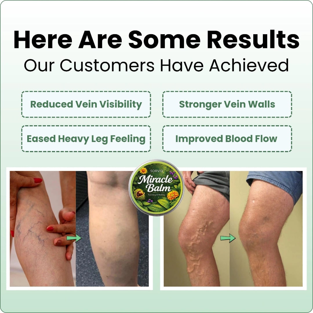 Swelling Cream with Diclofenac Sodium and Horse Chestnut for Varicose Veins Leg Balm - Image 5